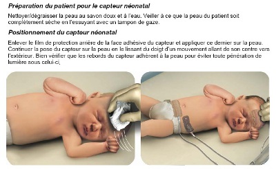 Mise en place des SOMASENSORS