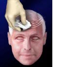 PREPARATION DU PATIENT
