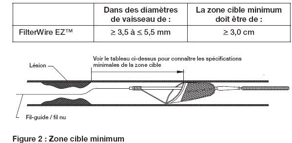 FilterWire EZ™2