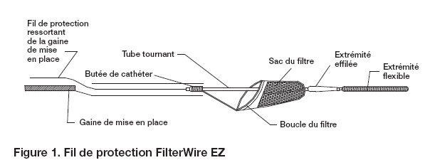 FilterWire EZ™1