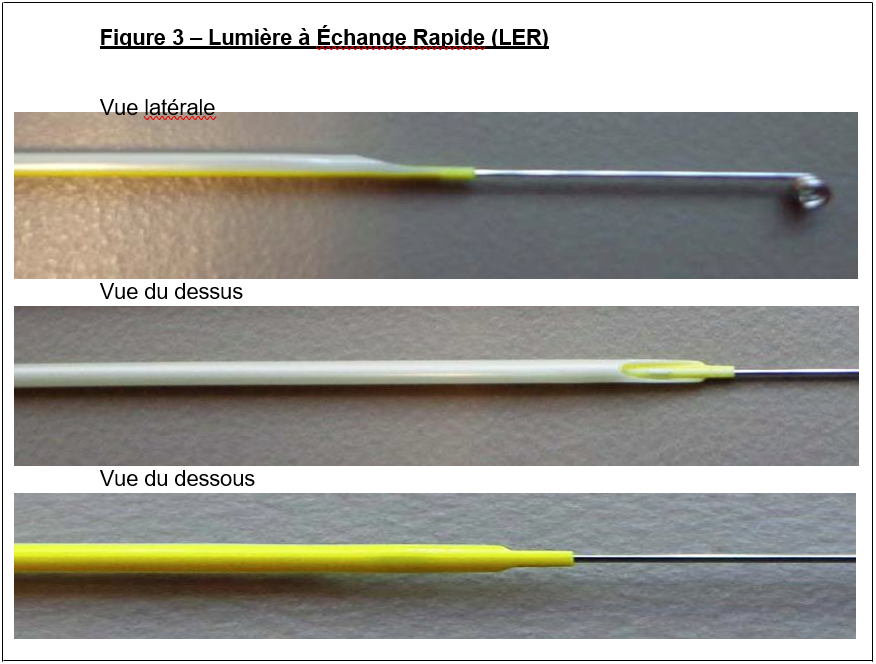 Lumière à Échange Rapide (LER)
