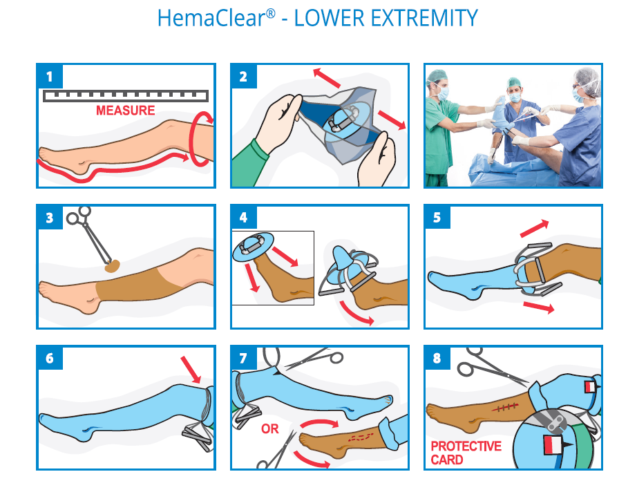 Installation HemaClear XL et XXL Membre Inférieur