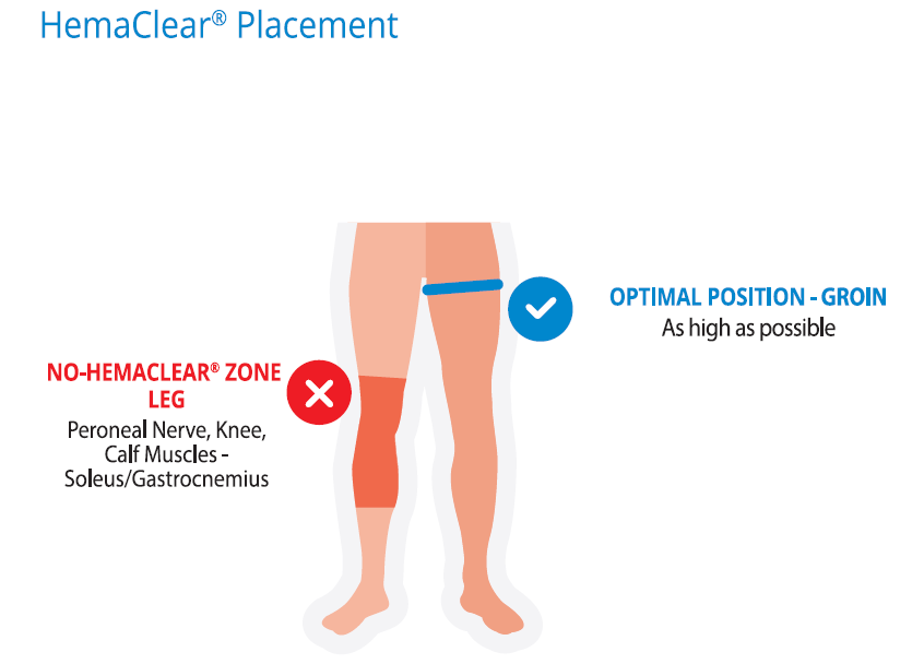 POSITION DU HEMACLEAR SUR MEMBRE INFERIEUR